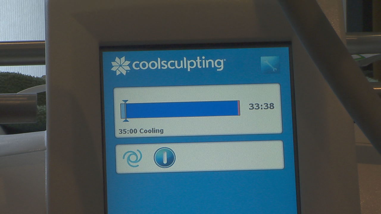 cool sculpt machine